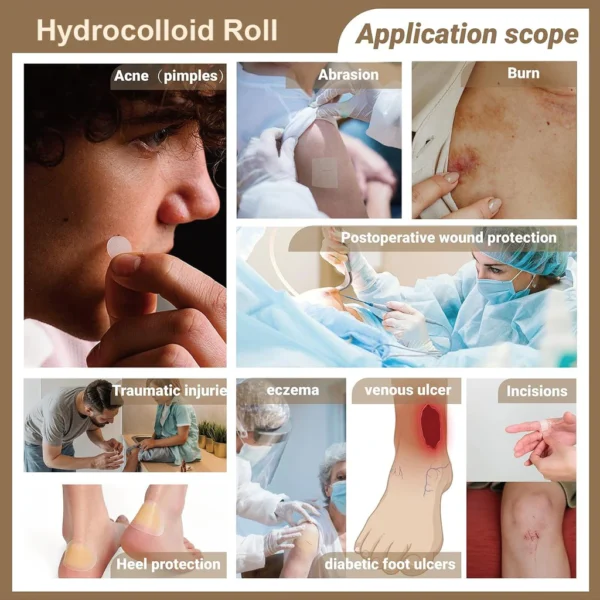 Medical Grade Hydrocolloid Bandage Roll