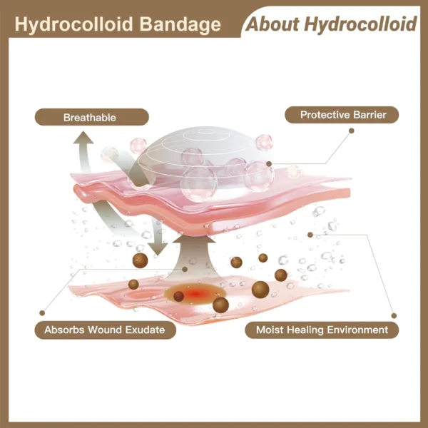 Medical Grade Hydrocolloid Bandage Roll