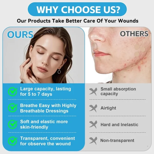 Hydrocolloid Wound Care Tape Roll